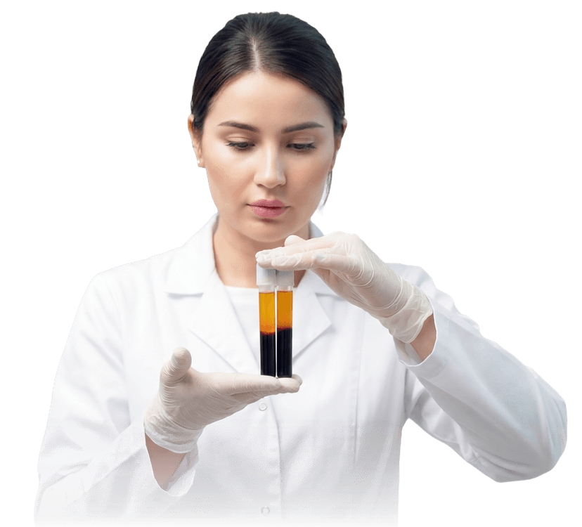 Golden platelet-rich plasma representing PRP therapy