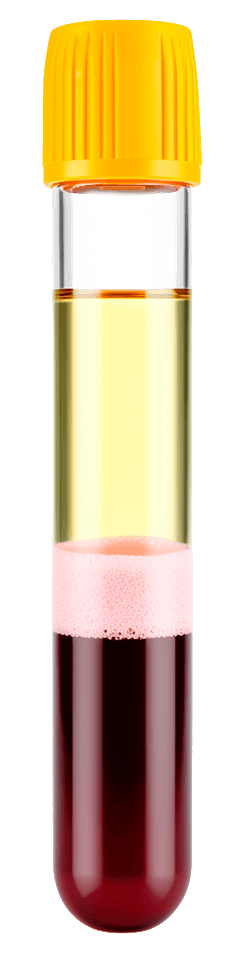 Selphyl Centrifuge Tube showing separated LP-PRP layers